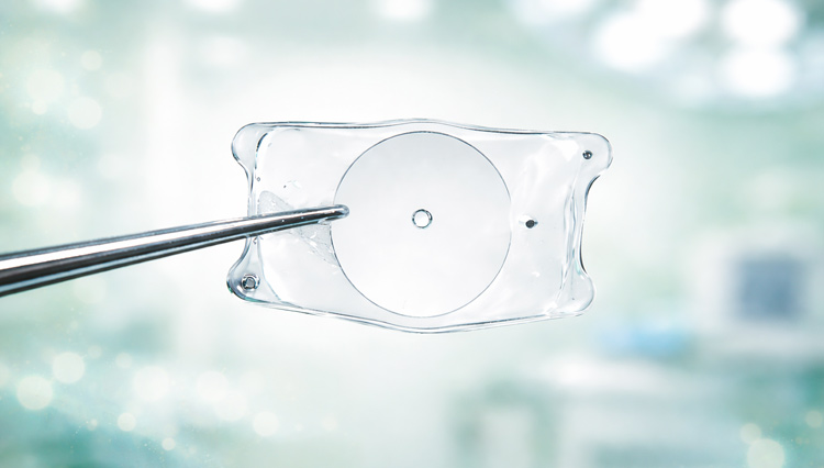 スターサージカル社の穴あきICLレンズ