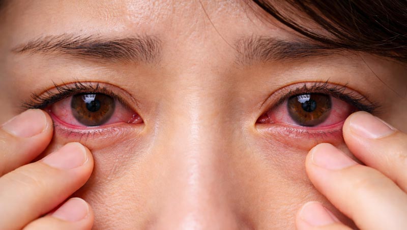 感染症の目イメージ