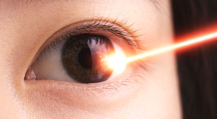 新宿のレーシックイメージ